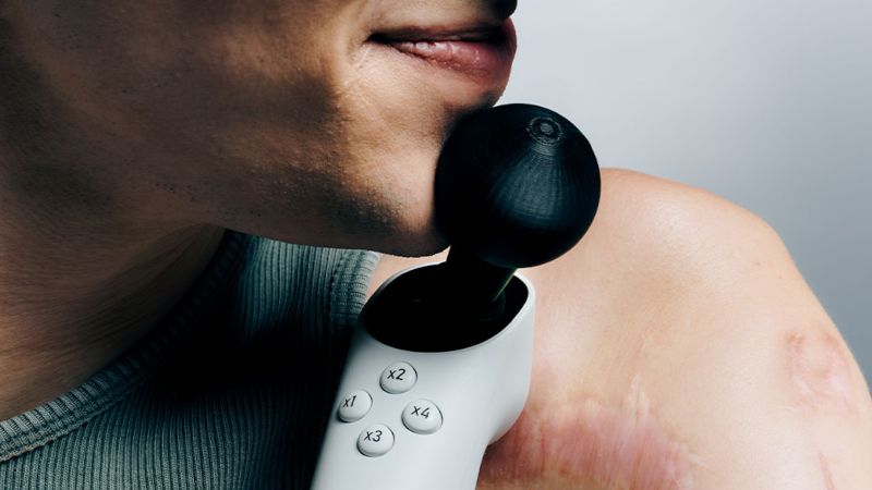 Le Joystick adaptatif Xbox : une avancée pour l'accessibilité